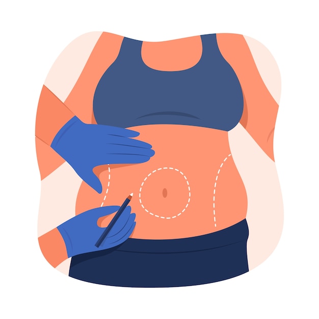 Hand drawn flat design liposuction illustration