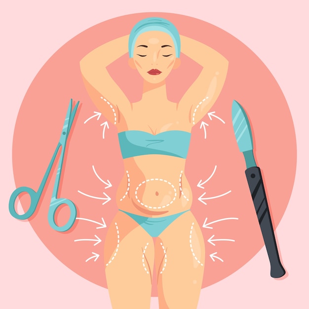 Hand drawn flat design liposuction illustration