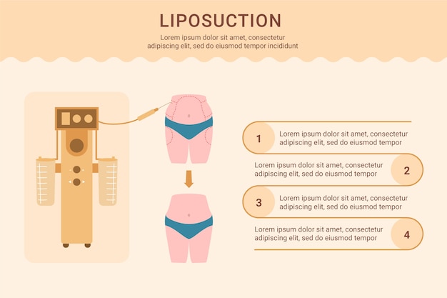 Hand drawn flat design liposuction infographic