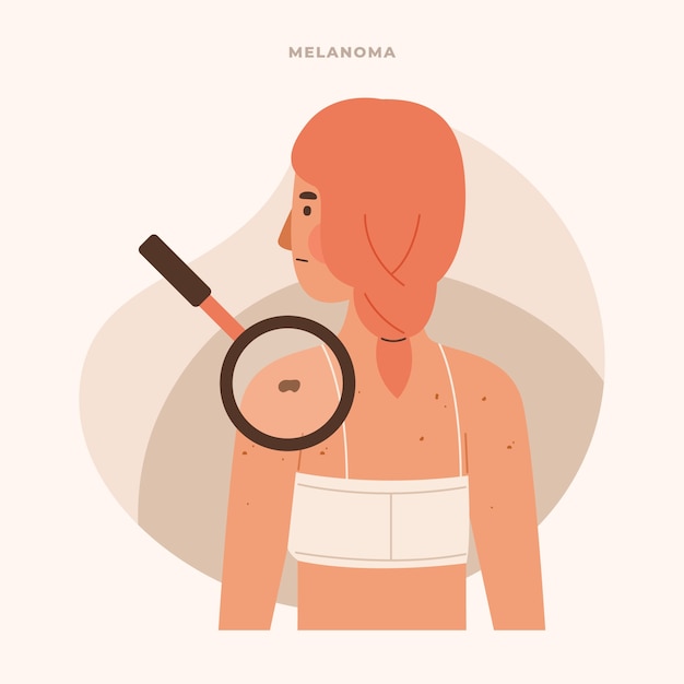 Hand drawn flat design melanoma illustration