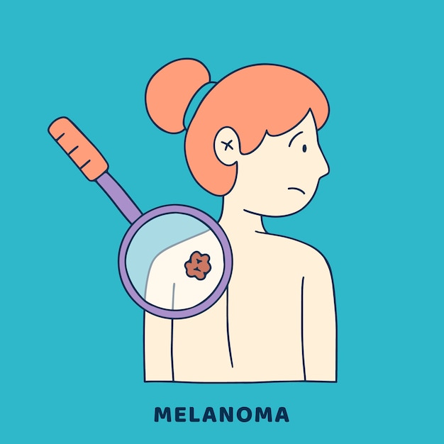 Free Vector hand drawn flat design melanoma illustration