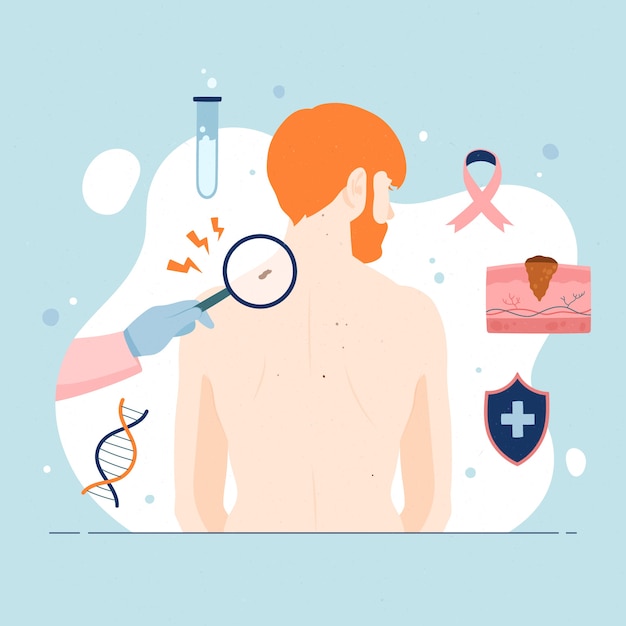 Hand drawn flat design melanoma illustration