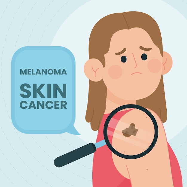 Free Vector hand drawn flat design melanoma illustration