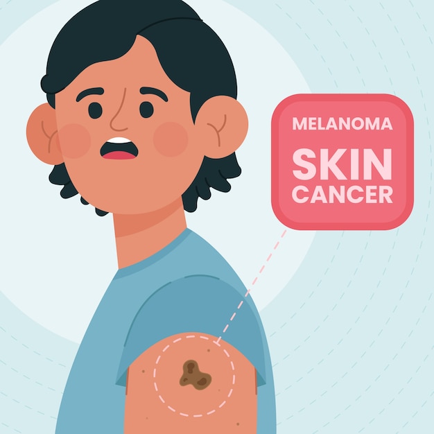 Hand drawn flat design melanoma illustration