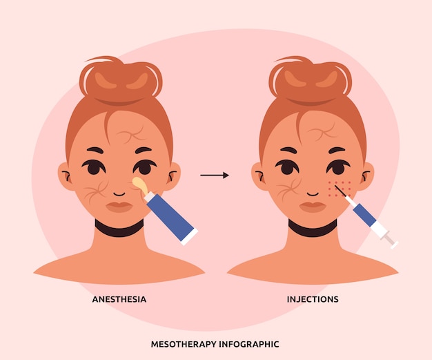 Hand drawn flat design mesotherapy infographic