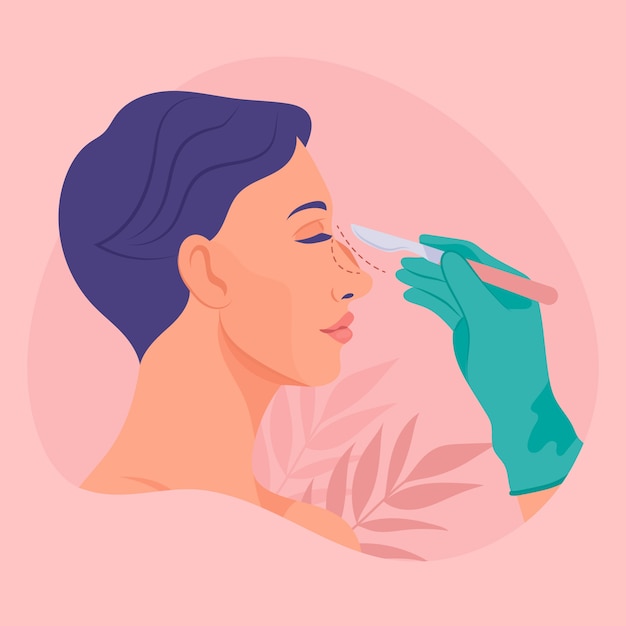 Hand drawn flat design rhinoplasty illustration