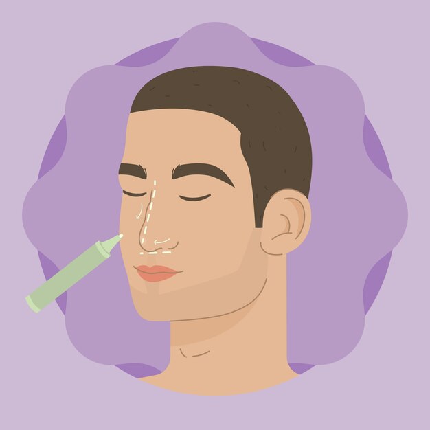 Hand drawn flat design rhinoplasty illustration