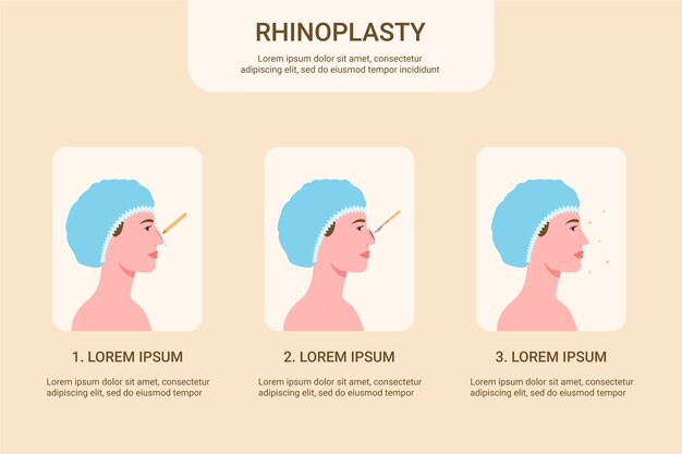 Hand drawn flat design rhinoplasty infographic