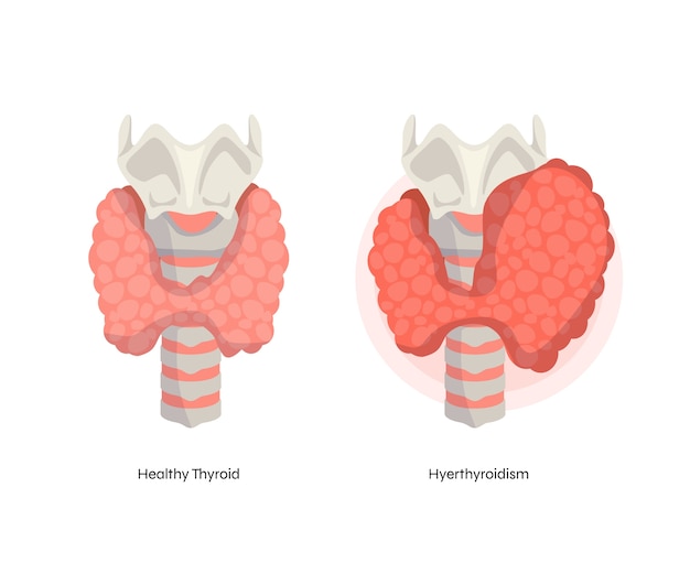 Hand drawn flat design thyroid illustration