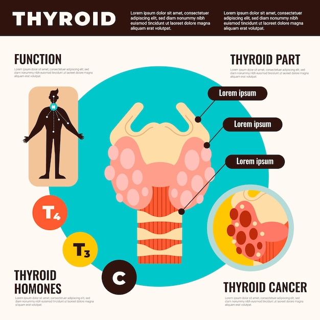 Free Vector hand drawn flat design thyroid infographic