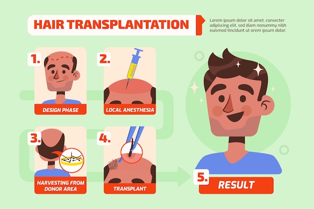 Free Vector hand drawn hair transplant infographic