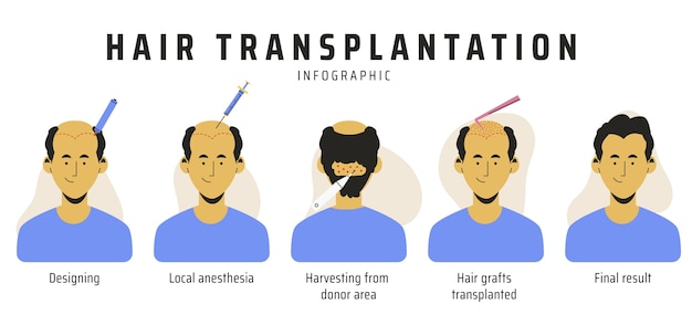 Free Vector hand drawn hair transplant infographic