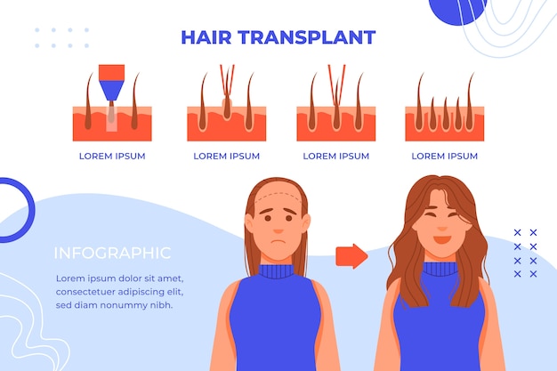 Hand drawn hair transplant infographic