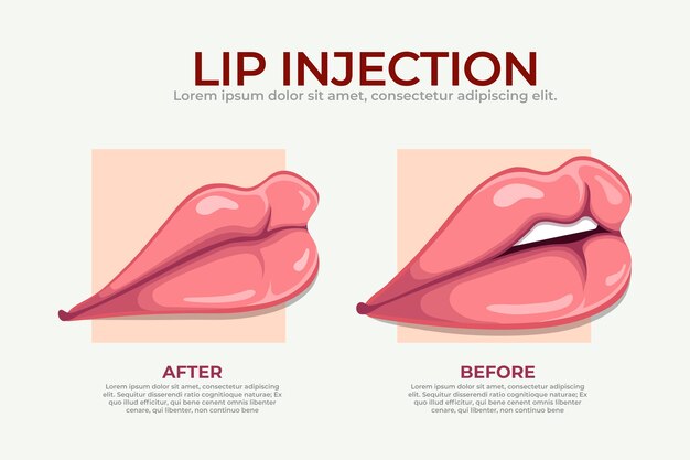 Hand drawn lip filler infographic