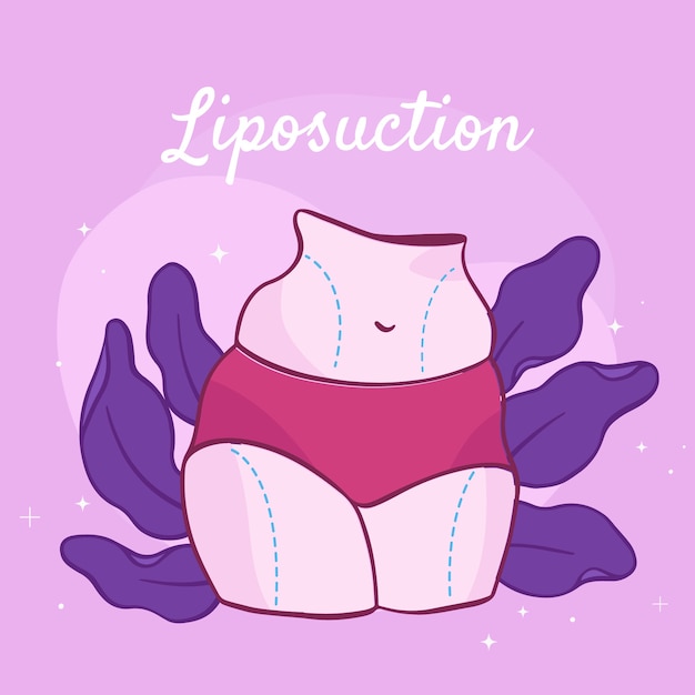 Hand drawn liposuction illustration