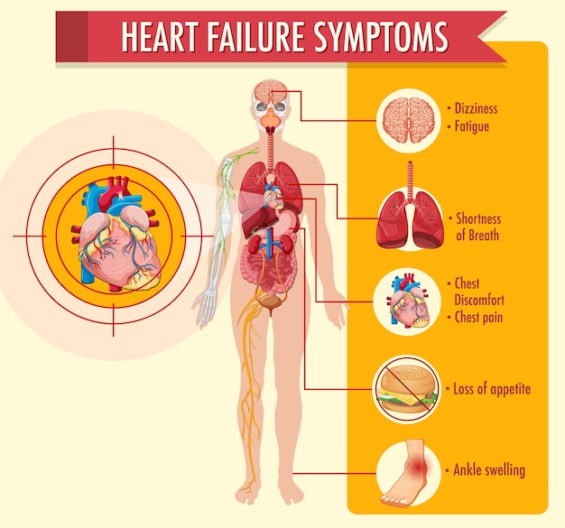 Heart failure symptoms information infographic