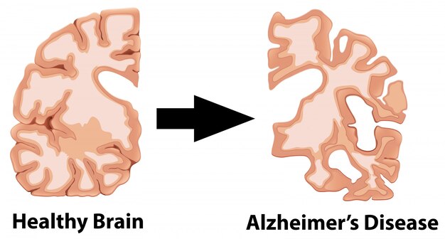 A Human Anatomy of Brain