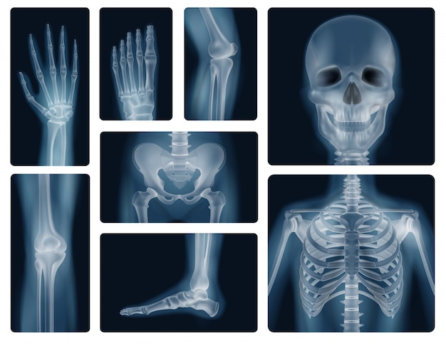 Free vector human bones realistic x-ray shots