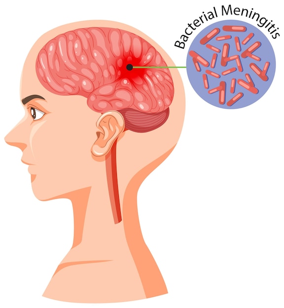 Human head section with brain