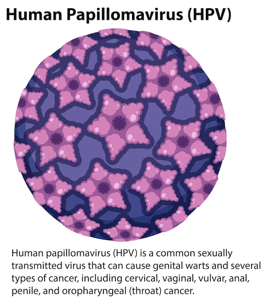 Free Vector human papillomavirus with explanation