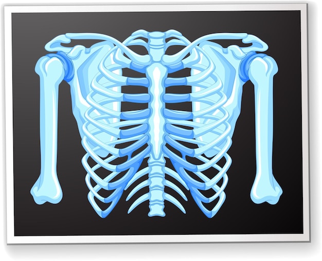 Free vector human rib cage xray illustration