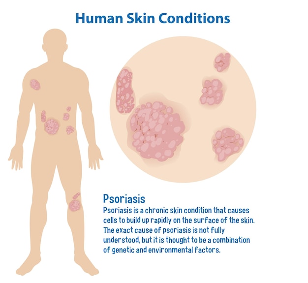 Human skin conditions infographic with explanation