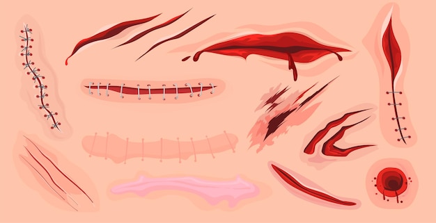 Free Vector human skin scars, cuts and bloody wounds flat set