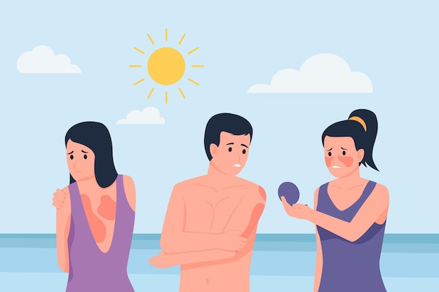 Illustrated flat people with a sunburn