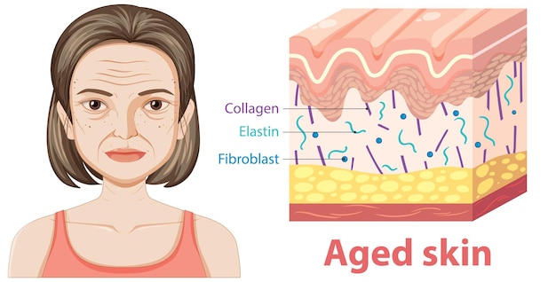 Free vector illustration of aged skin structure