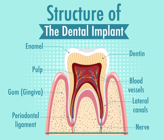 Infographic of human in structure of the dental implant