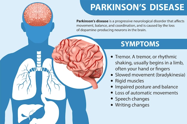 Free Vector informative poster of parkinson disease