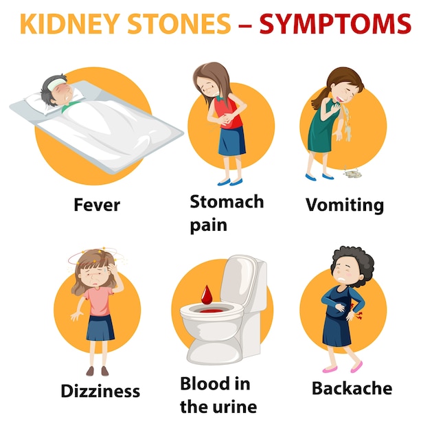 Free vector kidney stones symptoms cartoon style infographic