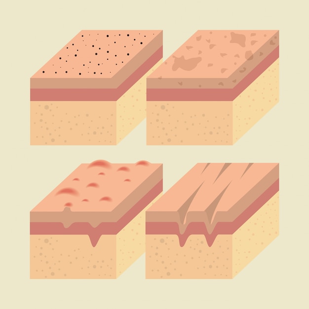 Free Vector layers of skin types