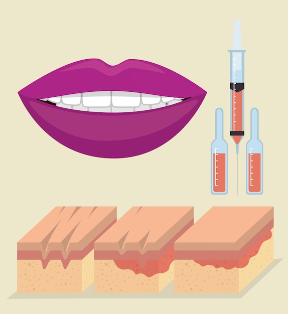 Free Vector layers of skin with botox injection