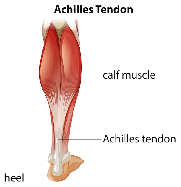 Free vector medical infographic of achilles tendon