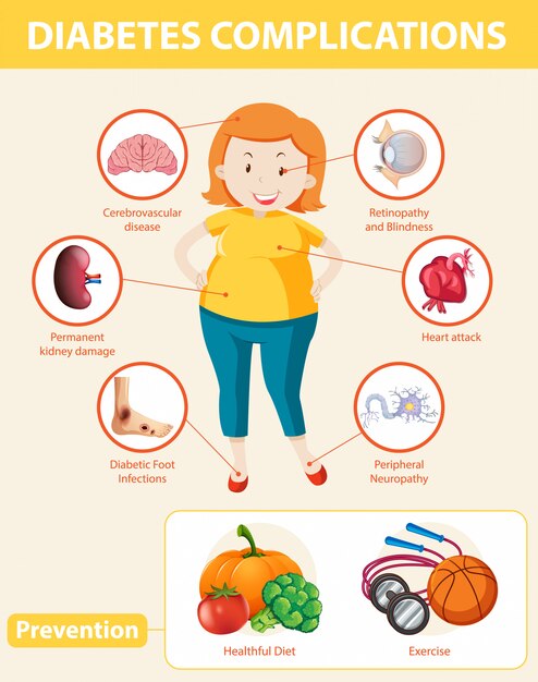 Medical infographic of diabetes complications and preventions