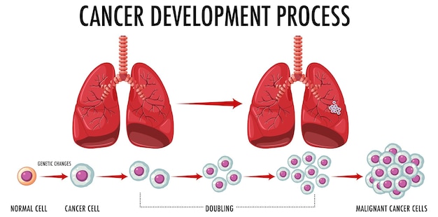 Process of cancer development infographic