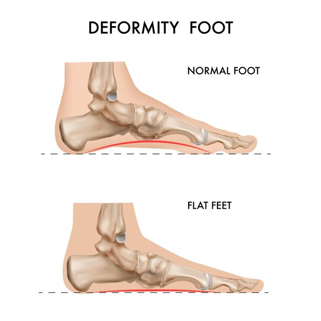 Realistic bones of anatomy foot