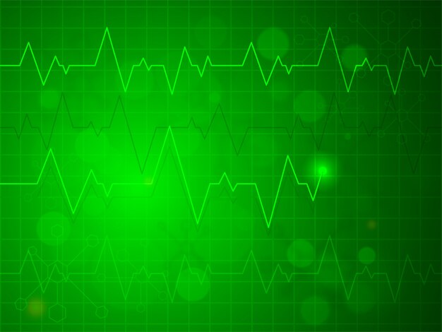  Shiny green heartbeat pulse or electrocardiogram design, Creative background for Health and Medical concept. 