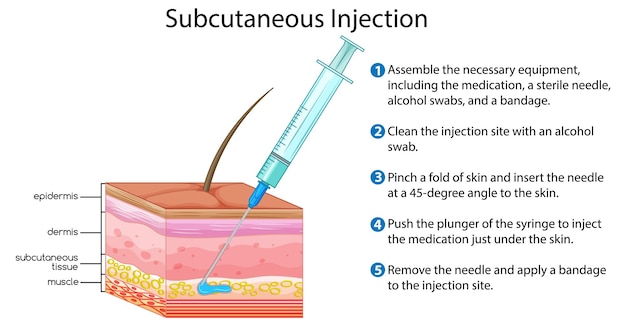 Free Vector subcutaneous injection with explanation