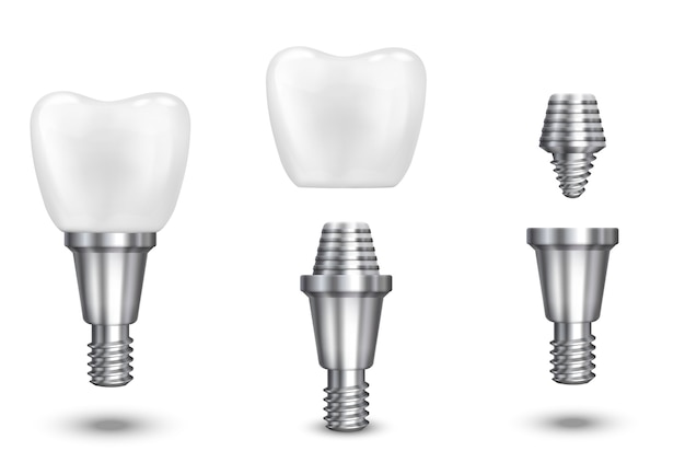 Tooth implant. Implant dental and health tooth, healthy implant, vector illustration