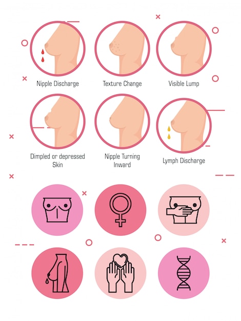 Free vector types of appearances of the breast