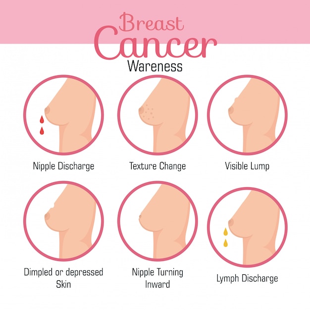 Free Vector types of appearances of the breast