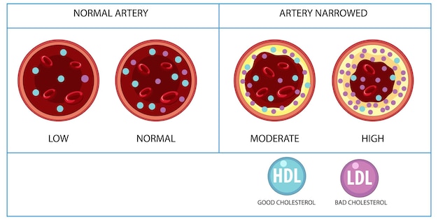 Free Vector types of cholesterol hdl and ldl