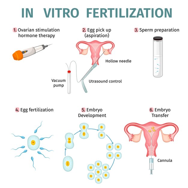 In Vitro Fertilization Concept