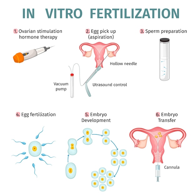 In Vitro Fertilization Concept