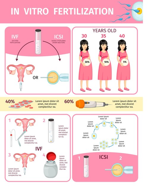 In Vitro Fertilization Infographic Concept