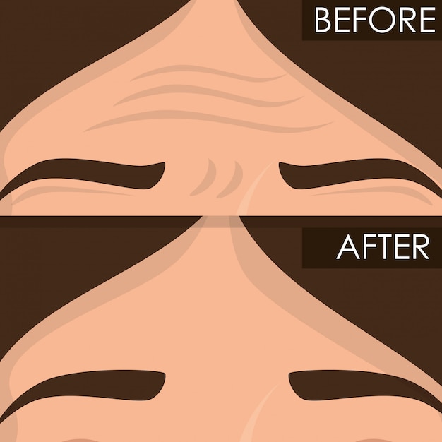 Free Vector woman before and after skin treatment