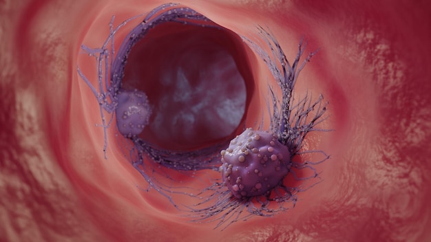 3d illustration of a cancer cellThe spread of the disease in the body Medical concept