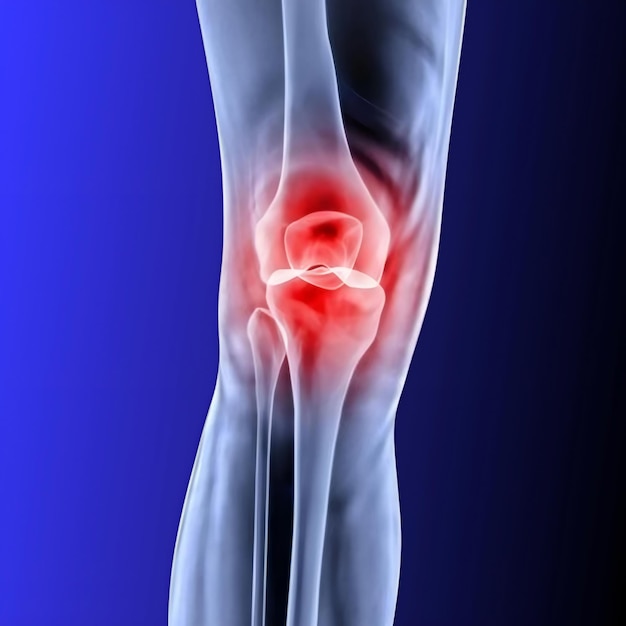 3D rendered medical image of anterior view of knee joint highlighting knee joint pain